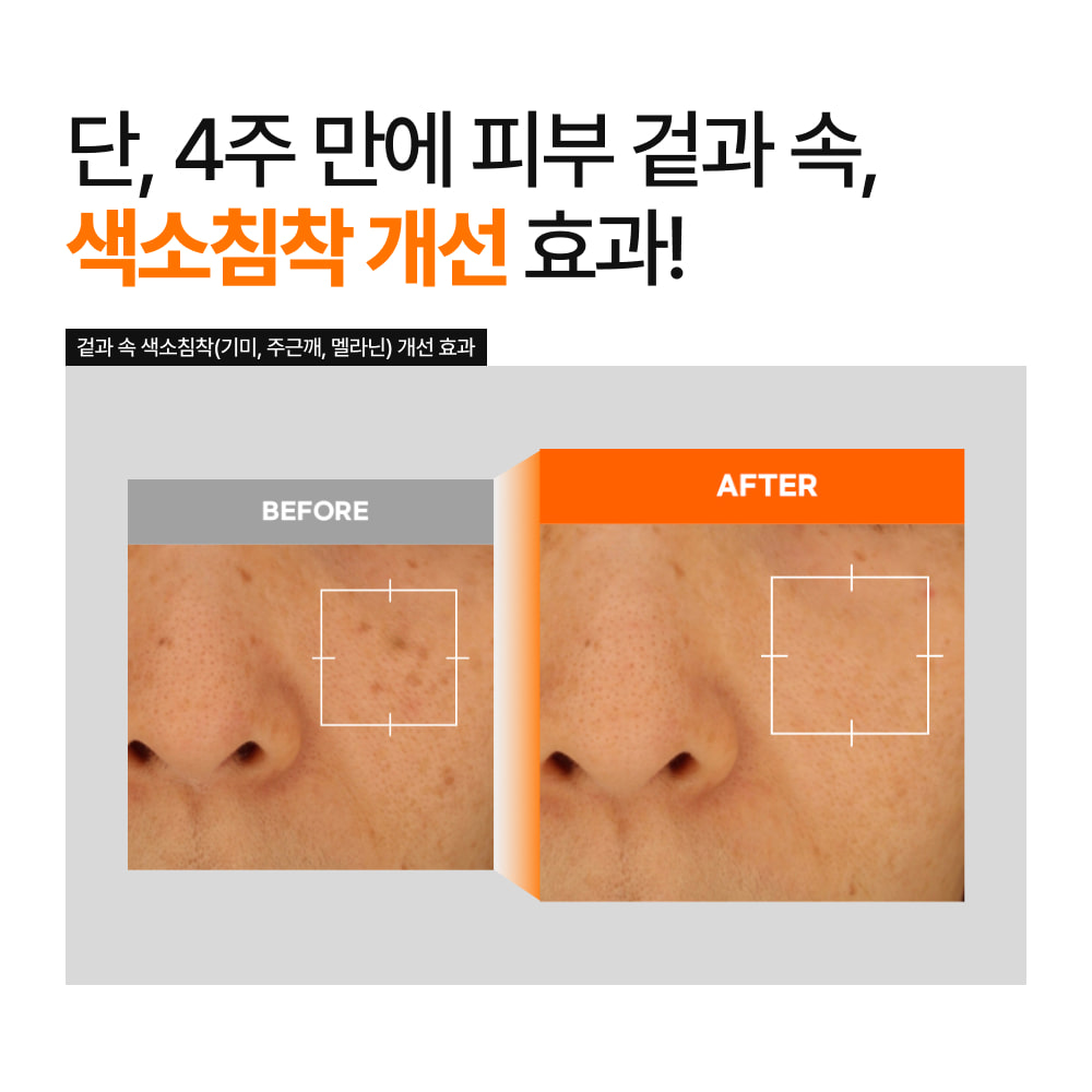 바르헤 글루타치온 화이트닝 크림 인 에센스 50ml